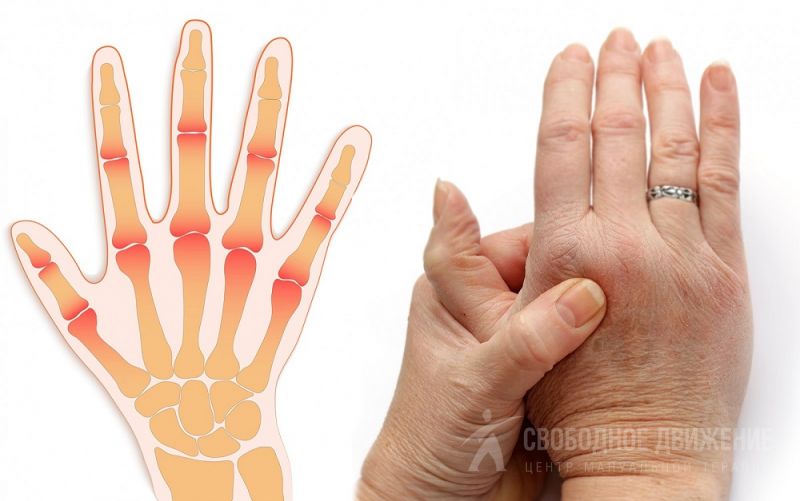 Диагностика и лечение заболеваний пальцев ног в клинике МАРТ
